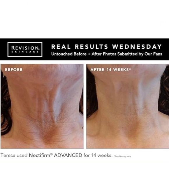 Revision Nectifirm Advanced NEW - Picture 3 of 3